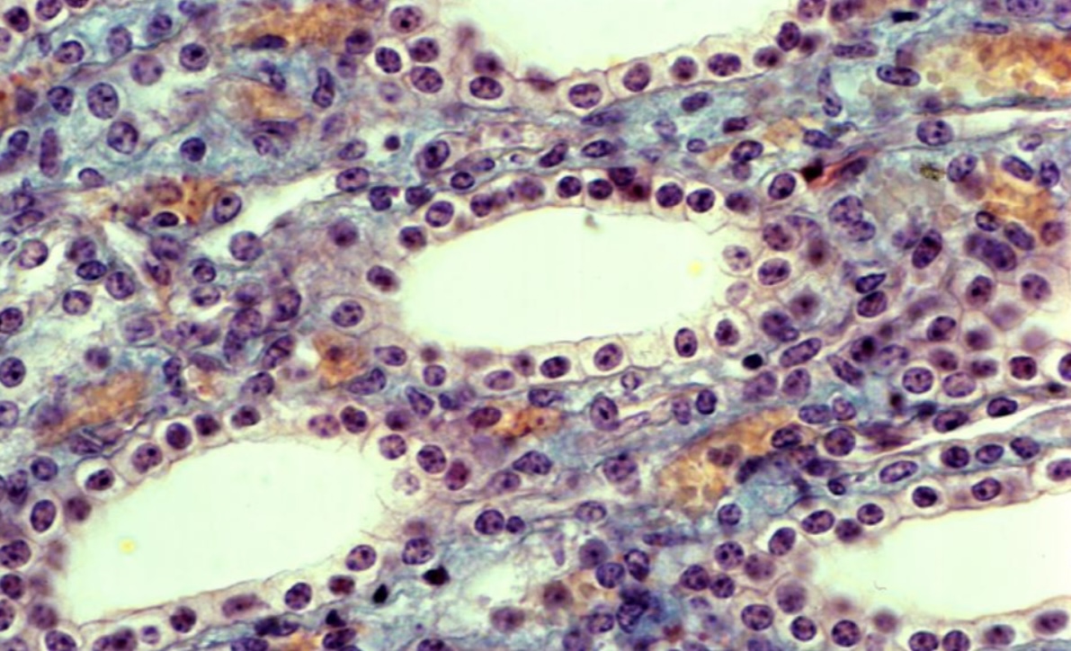 <p>What type of epithelium is this?</p>