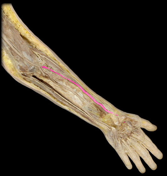 term image
