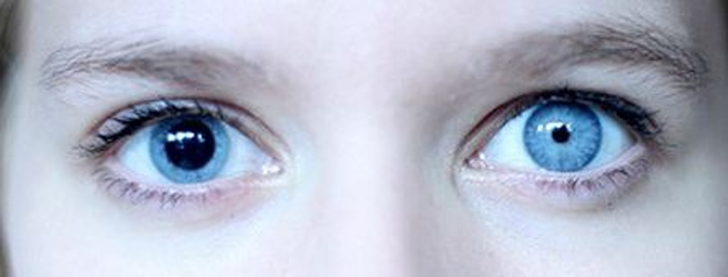 <p>Anisocoria</p>