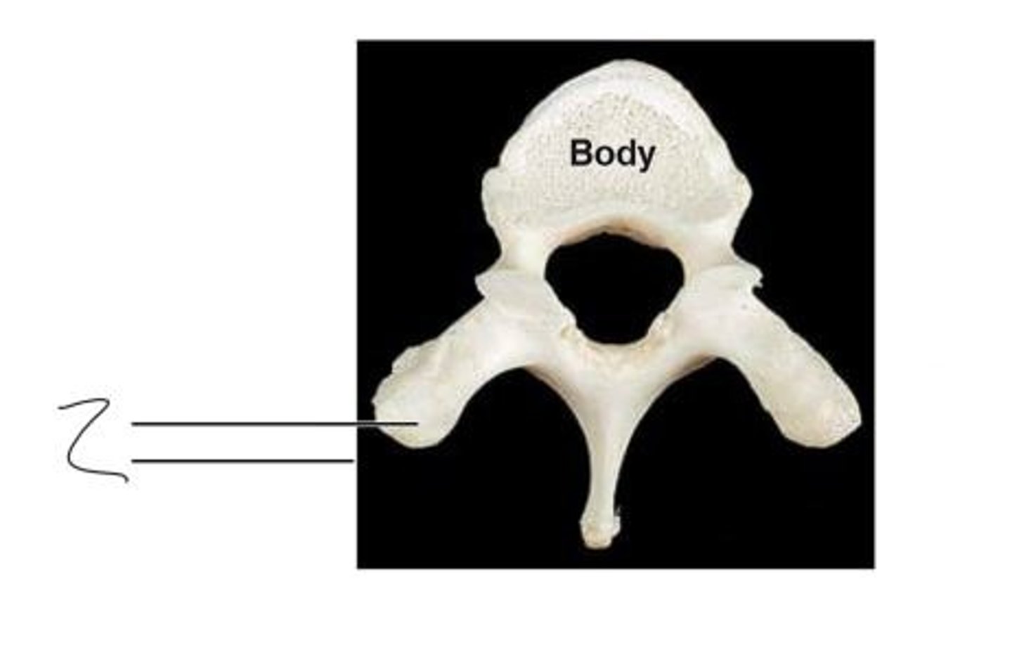 <p>What bone is this?</p>