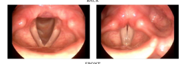 <p>Phonation types (when glottis is vibrating)</p>