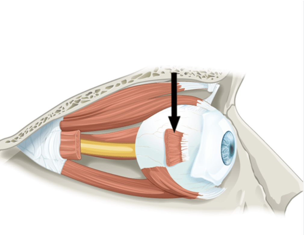 <p>This muscle of the eye has long straight fibers and is approximately the shape of a rectangle. Which of the following terms best fits this description?</p>
