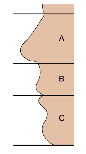 <ul><li><p>a set of guidelines with three divisions illustrating the considerations of vertical facial dimension</p></li></ul><p></p>