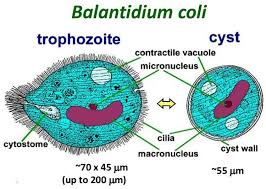 <p>Cysts are ingested, excystation occurs in the small intestine, and trophozoites colonise the large intestine. Usually asymptomatic</p>