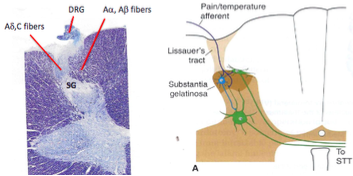-just after Lissauer's tract in the dorsal horns of the spinal cord 
-contains a lot cell bodies of neurons that are receiving information from pain and temperature primary afferents (a-delta and c fibers)