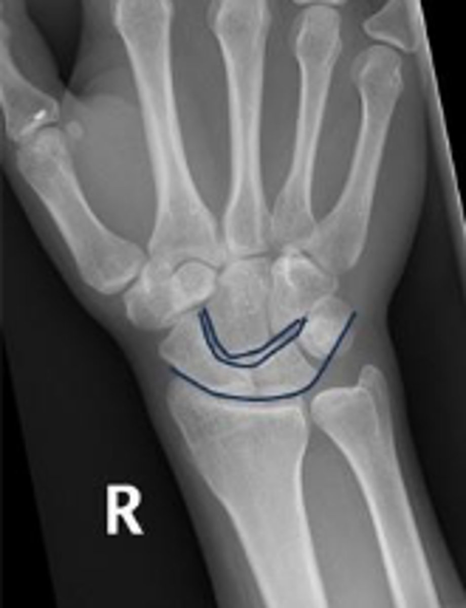 <p>Name 2 conditions that will result in an alteration of the assessment?</p>