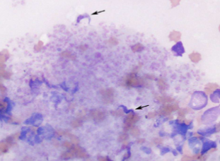 <p>What spreads&nbsp;Trypanosoma cruzi </p>