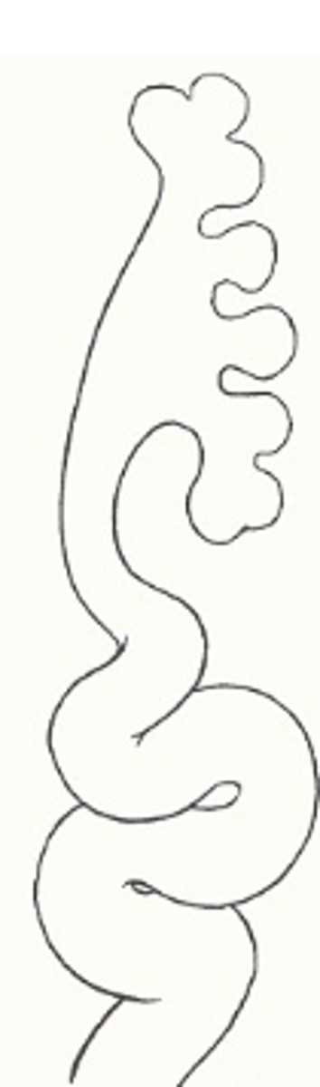 <p>Welke graad reflux wordt beschreven: uitgesproken dilatatie van de ureter met tortueuze ureter</p>