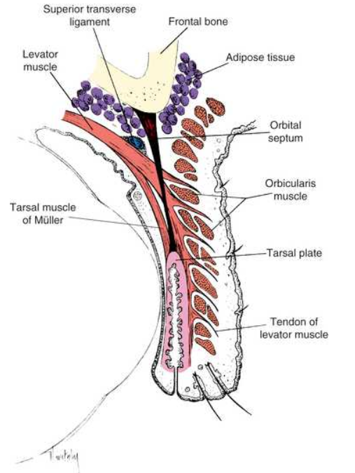 <p>is the retracctor of the upper eyelid</p><p>located within the orbit above the globe and extends into the upper eyelid.</p><p>originates on the lesser wing of the sphenoid bone aboove and infront of the optic foramen</p><p>superior transverse ligament- act as a fulcrum, changing the anteriposterior direction of the levator to superinferior.</p><p>picture shows saggital section of upper lid</p>