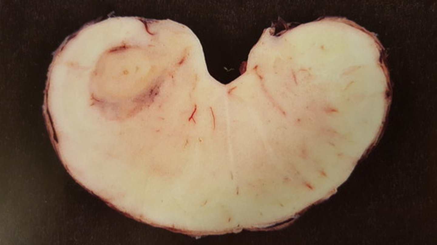 <p>Mesencephalon hos okse. Patoanatomisk diagnose? Hvordan kan det opstå?</p>