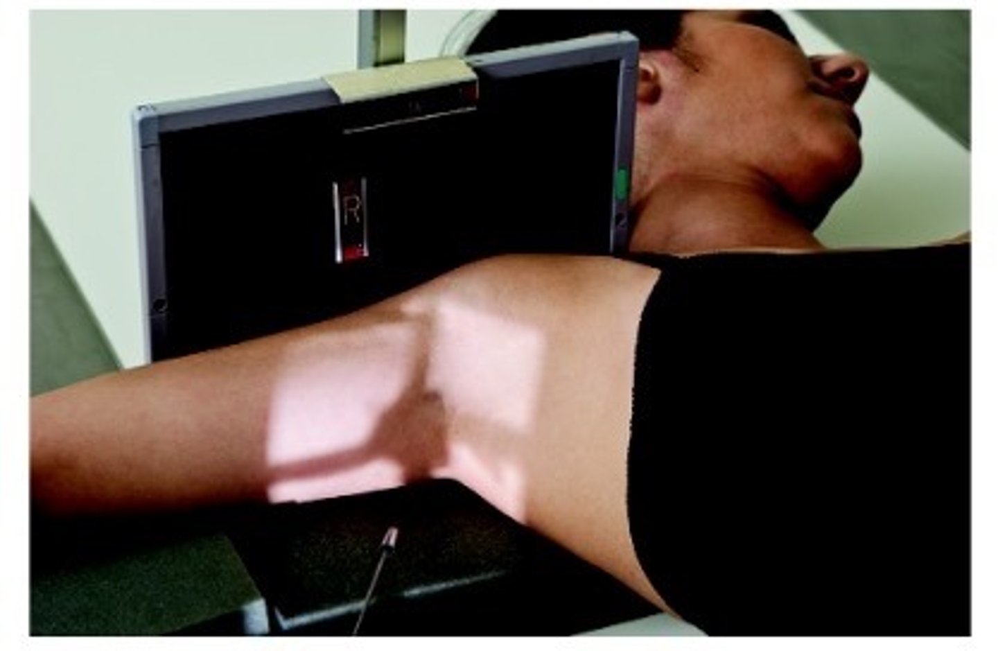 <p>CR angled 25-30° medially, coracoid process and lesser tubercle in profile (can see Hill-Sachs defect if it is exaggerated)</p>