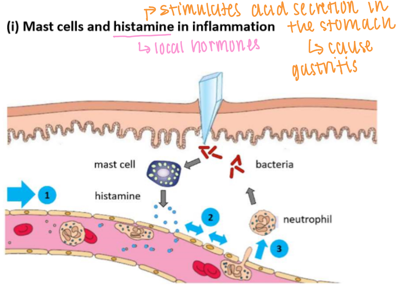 <p>1. Mast cells release histamines</p><p>2. Causes vasodilation → increased blood supply (redness + heat)</p><p>3. Causes increased vascular permeability (endothelial cells contract) → swelling &amp; pain</p><p>4. More WBC arrive to clear bacteria</p>