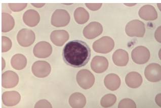 <p>what blood cells are these?</p>