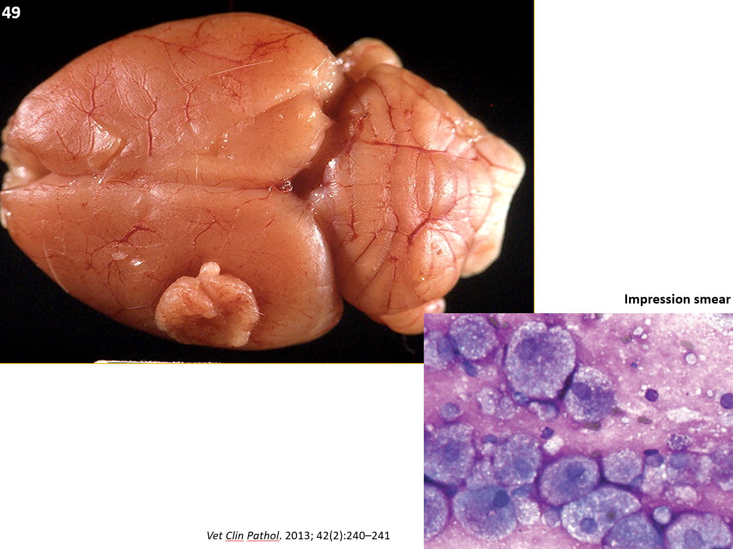 <p>49. Tissue from a Wistar rat. The cytoplasmic “granules” noted in the impression smear have been identified as:</p><p class="MsoListParagraphCxSpFirst"><span>a.</span><span style="font-size: 7pt; font-family: &quot;Times New Roman&quot;">&nbsp;&nbsp;&nbsp;&nbsp; </span>Mitochondria</p><p class="MsoListParagraphCxSpMiddle"><span>b.</span><span style="font-size: 7pt; font-family: &quot;Times New Roman&quot;">&nbsp;&nbsp;&nbsp;&nbsp; </span>Glycogen</p><p class="MsoListParagraphCxSpMiddle"><span>c.</span><span style="font-size: 7pt; font-family: &quot;Times New Roman&quot;">&nbsp;&nbsp;&nbsp;&nbsp; </span><span>Lysosomes</span></p><p class="MsoListParagraphCxSpLast"><span>d.</span><span style="font-size: 7pt; font-family: &quot;Times New Roman&quot;">&nbsp;&nbsp;&nbsp;&nbsp; </span>Rough ER</p>