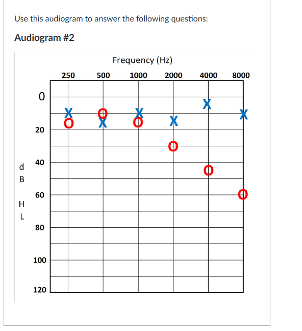 <p><span>Which speech sounds may be difficult to hear when listening in the right ear?</span></p>