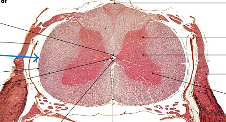 <p>Which meningeal layer is:</p><ul><li><p>Middle meningeal layer of spinal cord</p></li><li><p>Arachnoid membrane</p><ul><li><p>Simple squamous epithelia</p></li><li><p>Covers arachnoid mater</p></li></ul></li></ul><p></p>
