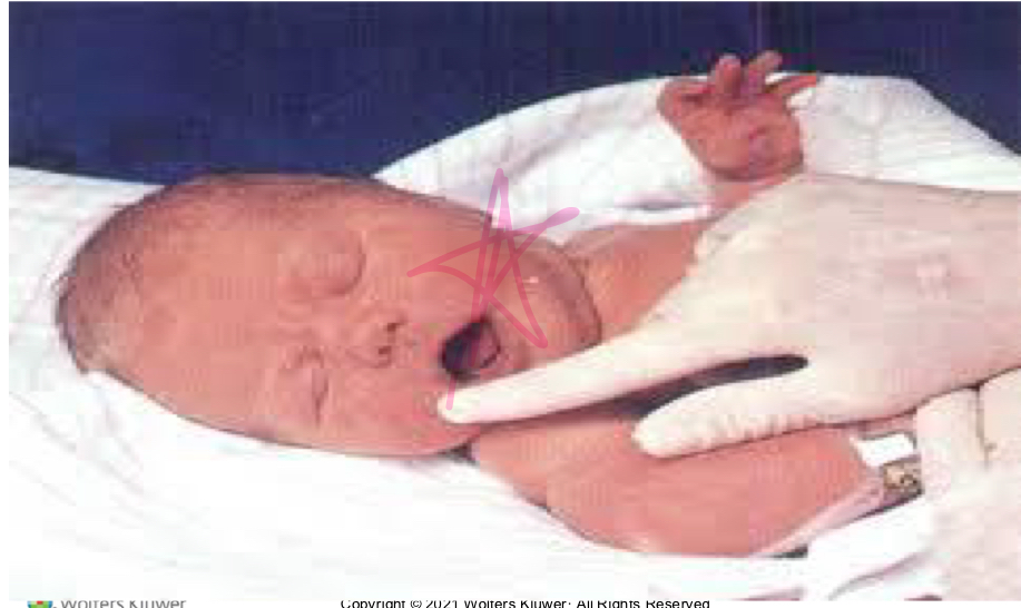 <p><span>upon touching or stroking their cheek or the corner of their mouth, the infant turns their head toward the stimulus and opens their mouth, preparing to feed</span></p>