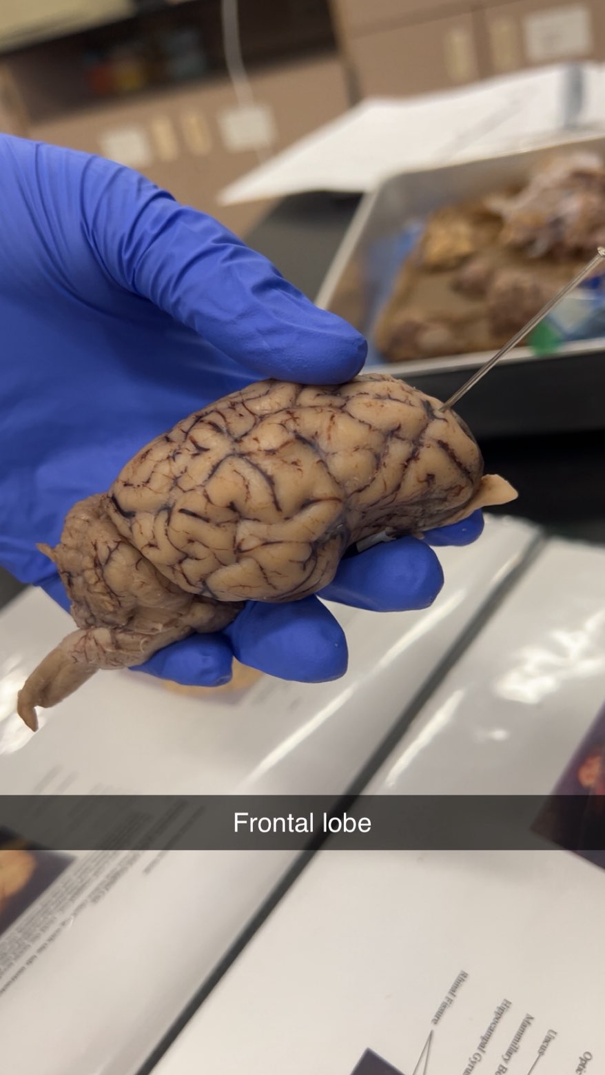 <p>frontal lobe</p>