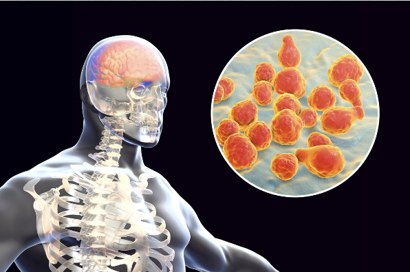 <p><span>Inflammation of the meninges, which cover and protect the brain &amp; spinal cord</span></p>