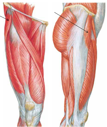 <p>What is the origin of this muscle?</p>