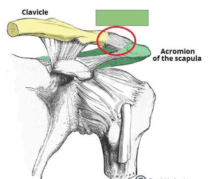 <p>Joint between the acromion of the scapula and the clavicle</p>