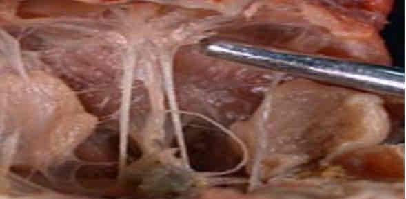 <p>Identify this structure</p>