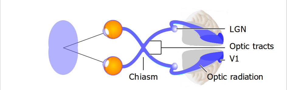 <p>Ganglion cell sends axons out the back of the eye in the blind spot → these axons form the optic nerve (cranial nerve II) → optic nerves from both eyes meet at the optic chiasm → nasal retinal fibers cross to the other side, temporal retinal fibers do not cross → information from the left visual field goes to the right hemisphere, information from the right visual field goes to the left hemisphere → From the chiasm, the nerve bundles are called optic tracts → end in the 2 lateral geniculate nuclei (LGN) in the thalamus → project optic radiations to the primary visual cortex called V1</p><p>V1 is in occipital lobe and is responsible for processing visual information</p><p></p><p></p>