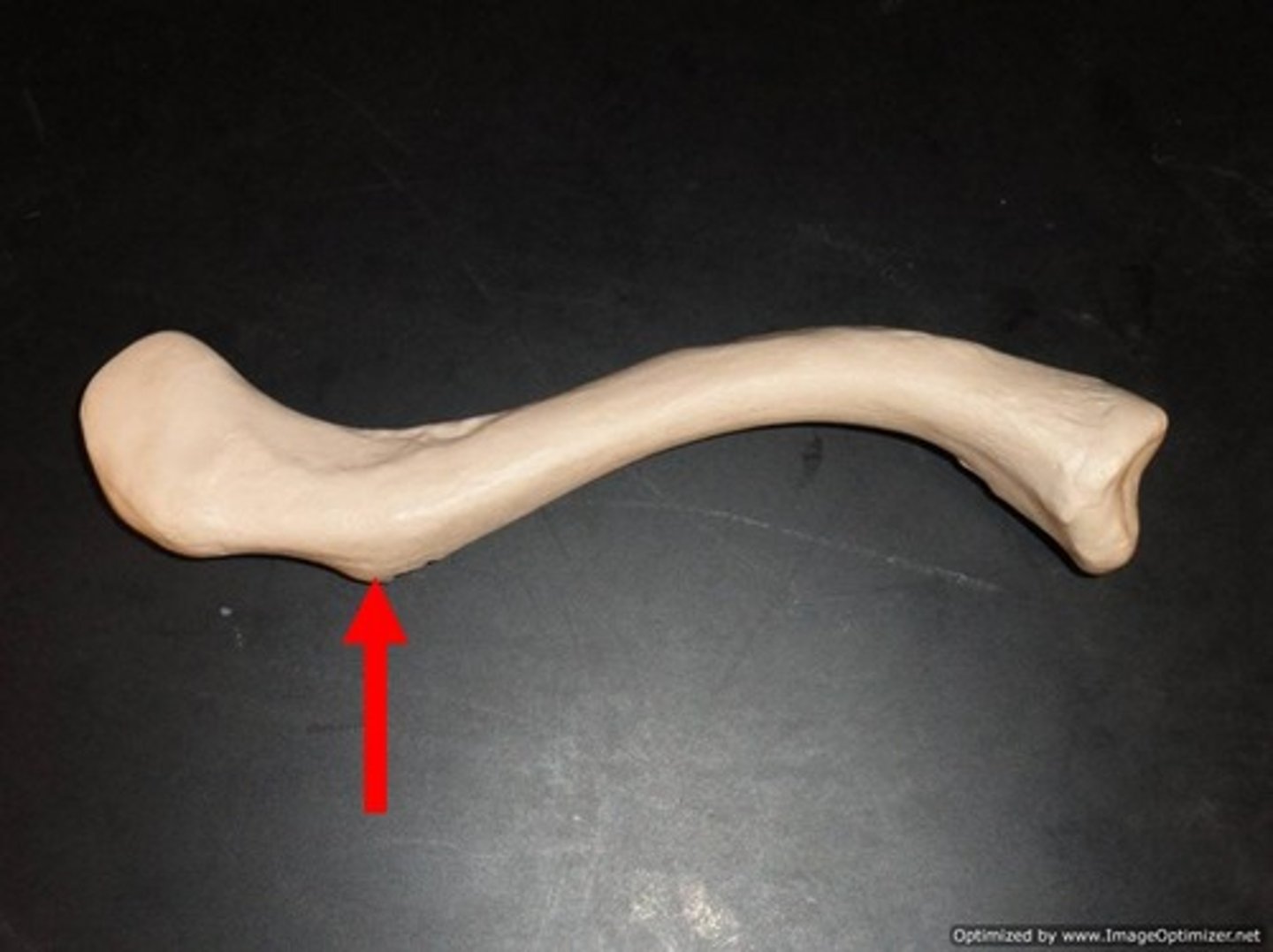 <p>near acromial end of clavicle</p>