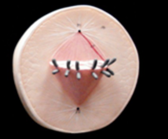 <p>Name this Mitosis Phase?</p>