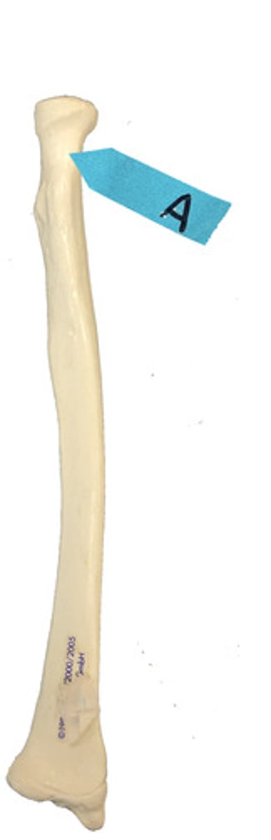 <p>Identify this bone marking.</p>