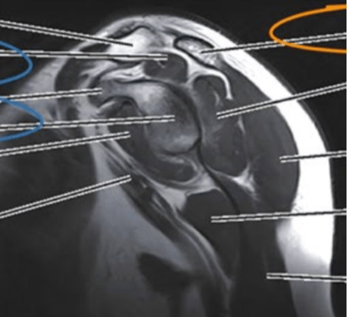 <p>what view is this and what imaging type?</p>