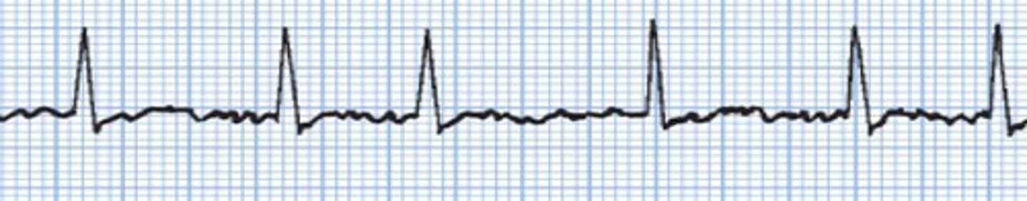 <p>What rhythm is this?</p>