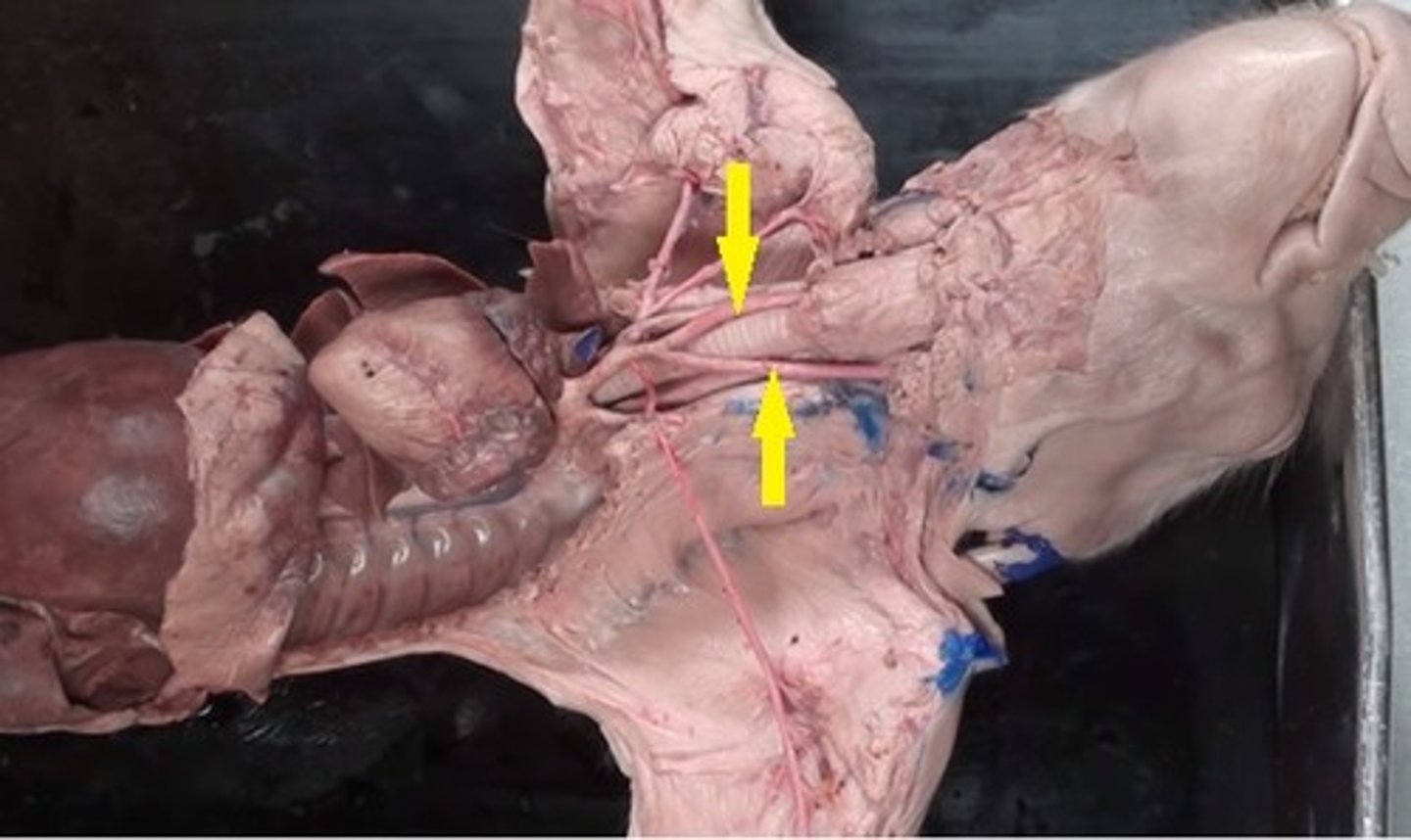 <p>Common carotid arteries</p>