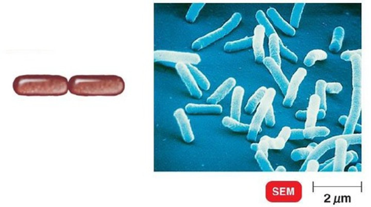 <p>pairs of bacilli</p>