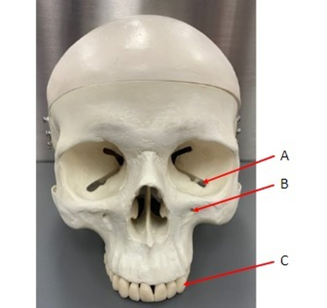 <p>Identify</p>