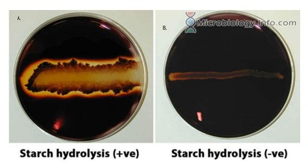 <p>Temp: 37 degrees C Test for amylase using Gram&apos;s iodine solution Positive result: clear zones surrounding bacterial growth indicated the absence of starch. Negative result: a starch-iodine complex produces a deep purple to black color</p>