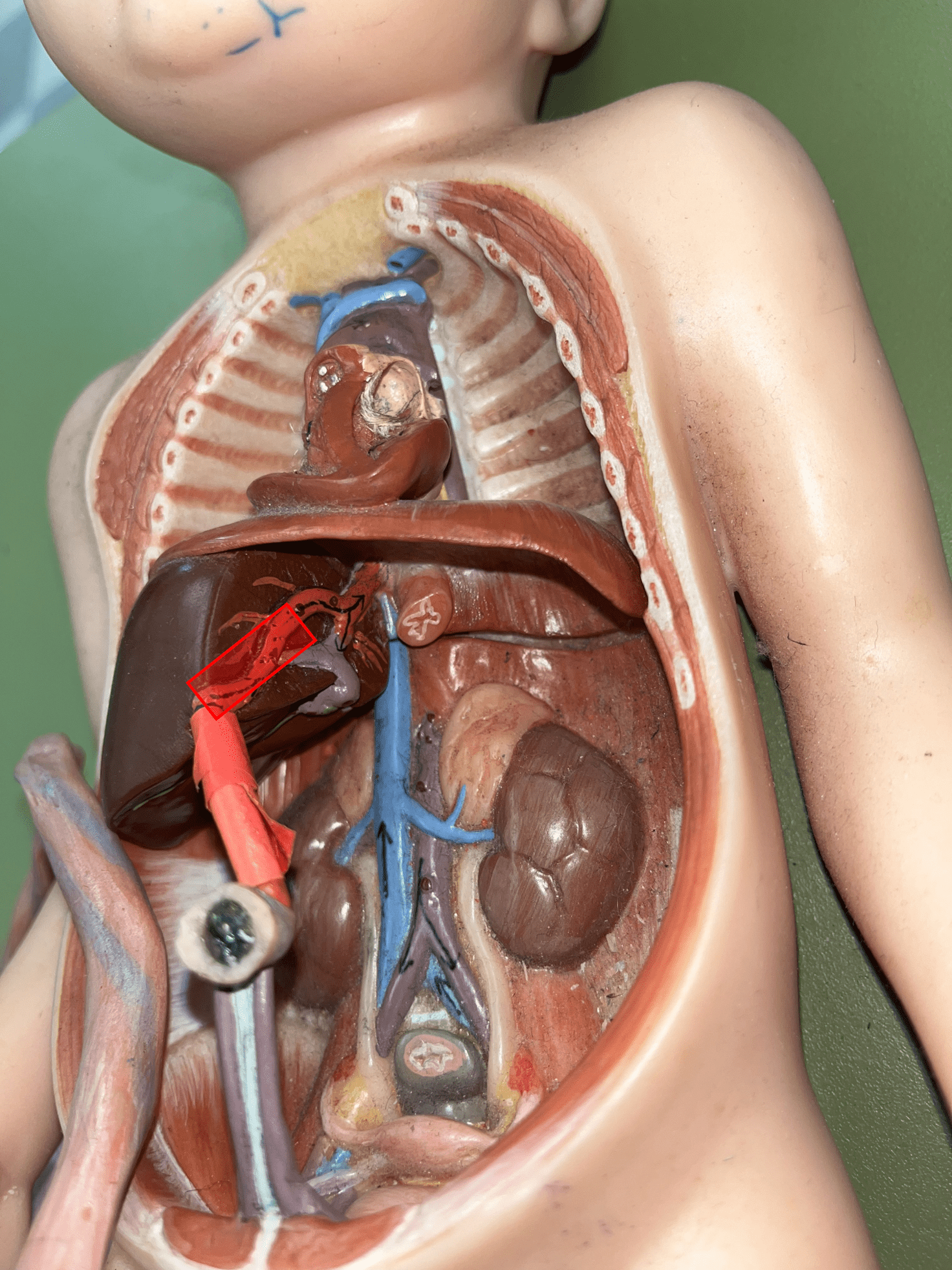 <p>• Part of the fetal circulation.</p>
<p>• Carries oxygen and nutrients from the placenta through the umbilical cord.</p>