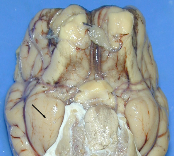 <p>arachnoid mater</p>