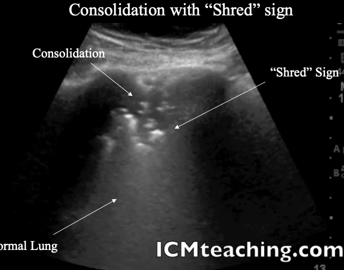 <p>What is a Shred sign?</p>