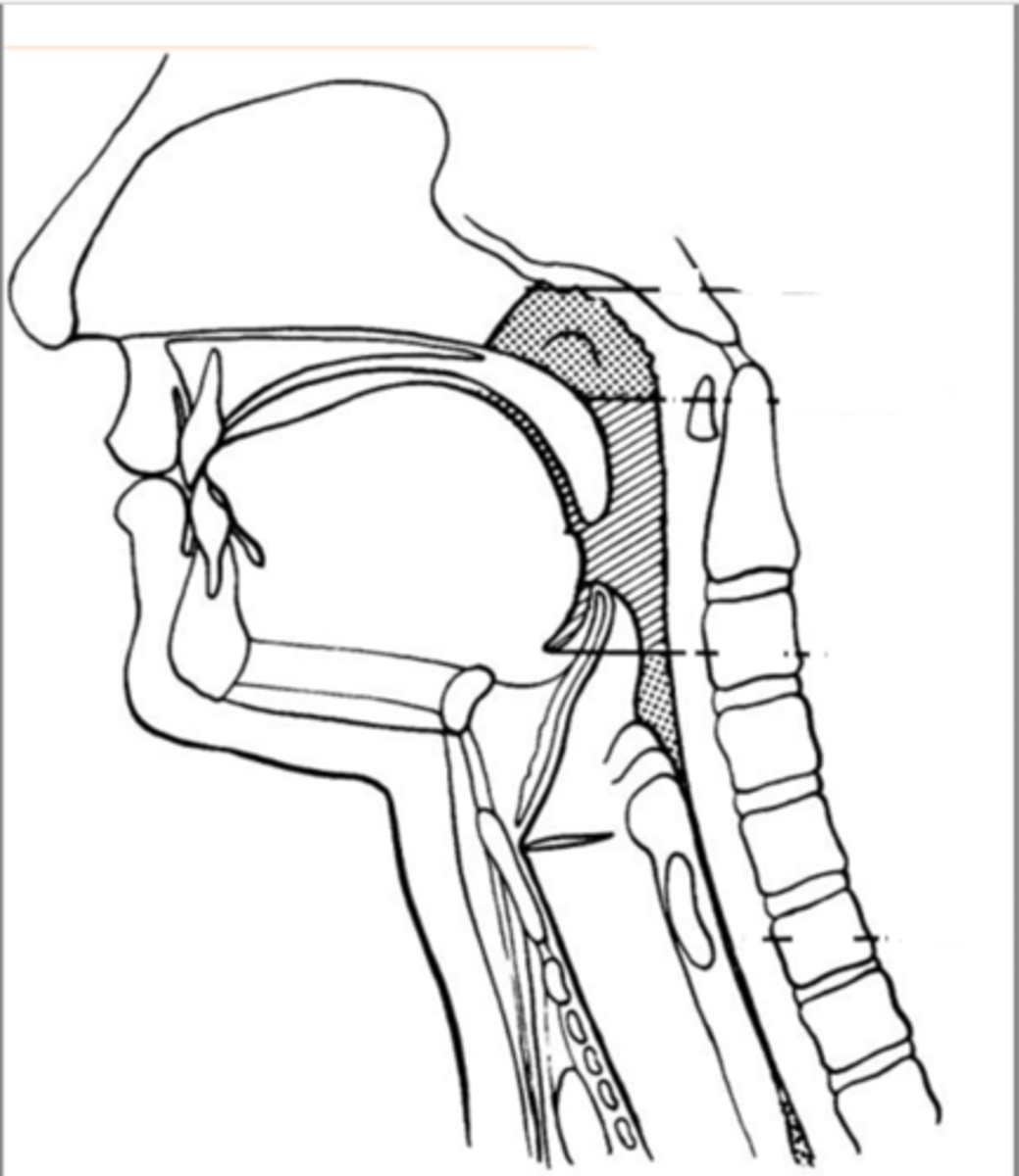 <p>normal sensation of tongue but impaired taste sensation on anterior 2/3rds</p>