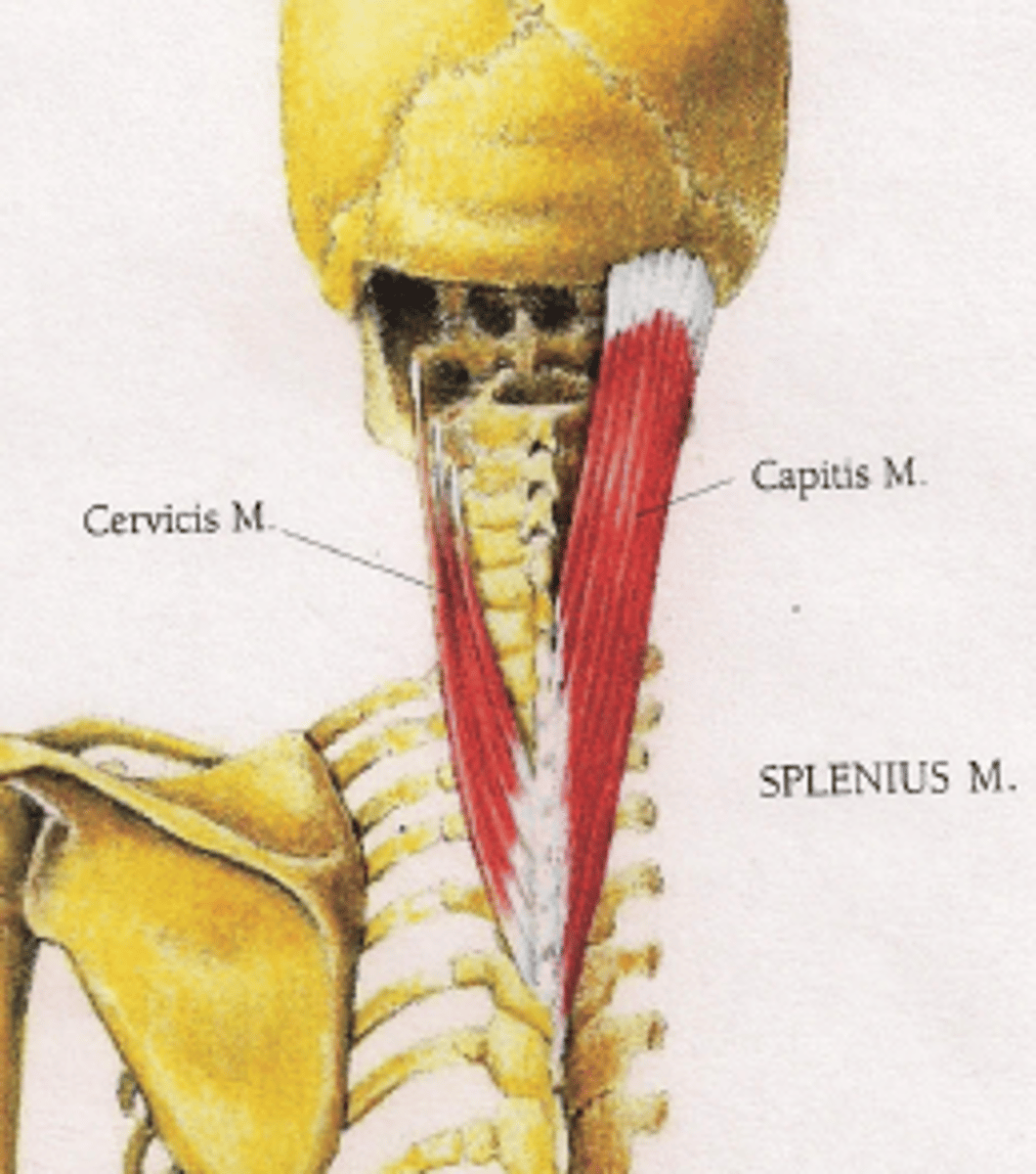<p>Origin:</p><p>ligamentum nuchae; spinous processes T3-6</p><p>Insertion:</p><p>Transverse process C1-3</p>