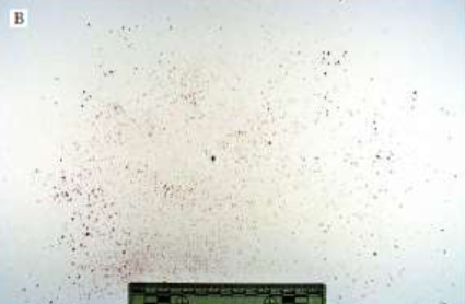 <p>What Bloodstain pattern is this?</p>