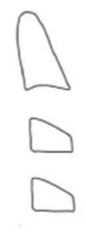 <ul><li><p>concavity at lower border of C2 in 80%'</p></li><li><p>C3 and C4 are still trapezoid shaped</p></li><li><p>peak growth is a year or so ahead</p></li><li><p>ideal stages to begin functional jaw orthopaedics for skeletal class III with mx deficiency</p></li></ul><p></p>