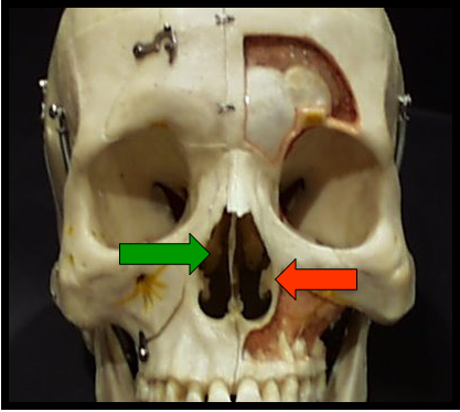 <ul><li><p><span>A pear-shaped compartment of bone located superior to the maxilla</span></p></li><li><p><span>Are wafer-thin, curved plates of bone that extend from the lateral walls of the nasal cavity.</span></p></li></ul><p></p>