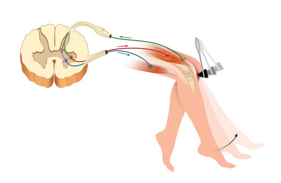 <p>Reflex = automatische responss do eenvoudigste circuit, vormt een reflexboog</p><p>kniereflex: </p><ol><li><p>druk op pees =stimuli</p></li><li><p>samentrekking spieren (quadriceps) die sensibele receptoren bevat </p></li><li><p>signaal opgenomen door sensibele neuronen doorgestuurd via ruggenmerg </p></li><li><p>in grijze stof signaal doorgegeven aan motorische neuronen, soms dmv van interneuronen </p></li><li><p>motorische neuronen stuur signaal door naar spieren (quadriceps)</p></li><li><p>contractie spier </p></li></ol><p></p>