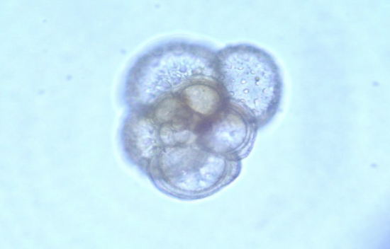 <p>one image example: </p>