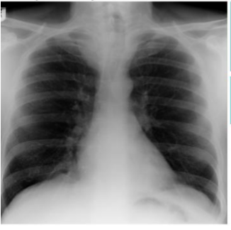 <p>what is this?</p>