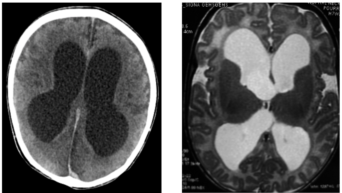 <p>What is shown in these imaging?</p>