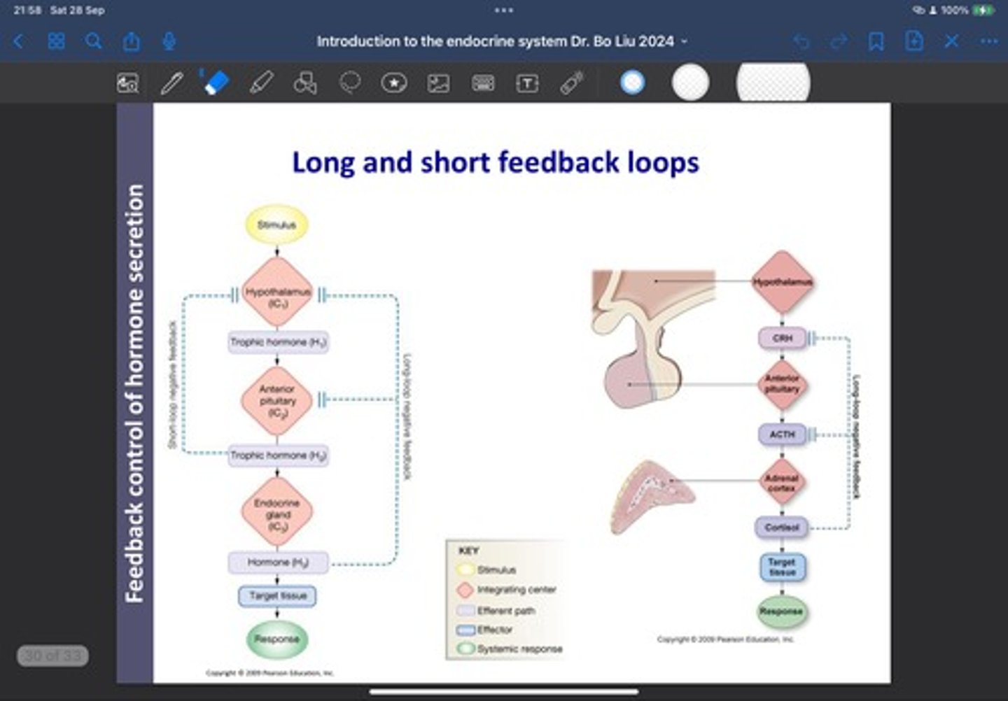 <p>-The secretion of hormones are regulated via feedback loops (mostly negative)</p><p>-The response can involve multiple organs</p><p>Example:</p><p>When the Hypothalamus releases Cortical Releasing Hormone (CRH - a protein), this triggers the Anterior Pituitary to release Adrenocorticotropic hormone (ACTH) which triggers the Adrenal Cortex to release Cortisol.</p><p>Cortisol can generate a negative feedback loop to switch of the release ACTH.</p><p>At the same time, Cortisol can also feedback to the hypothalamus to switch off the release of CRH, which is described as a long feed back loop because it involves 3 endocrine organs (Hypothalamus, Anterior pituitary and the Adrenal cortex)</p><p>Note:</p><p>ACTH can also feedback to the Hypothalamus to switch off the release of CRH which is also a short negative feedback loop</p><p>-Can be controlled in a more controlled way</p>