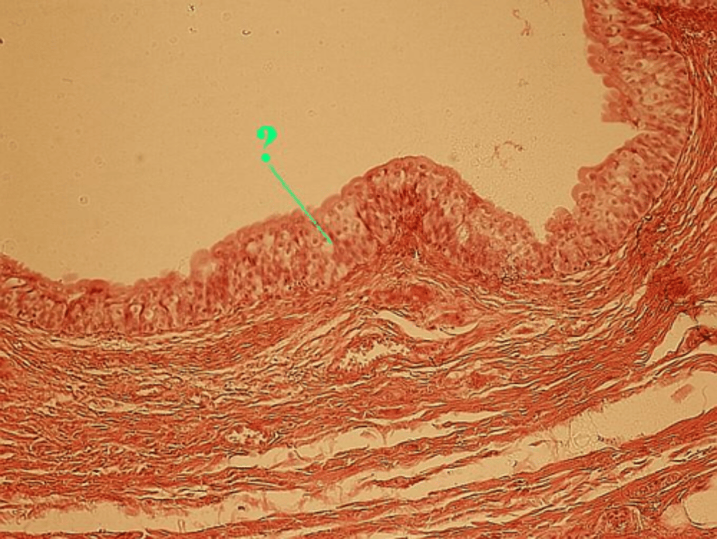 <p>What type of epithelium is present in the bladder?</p>